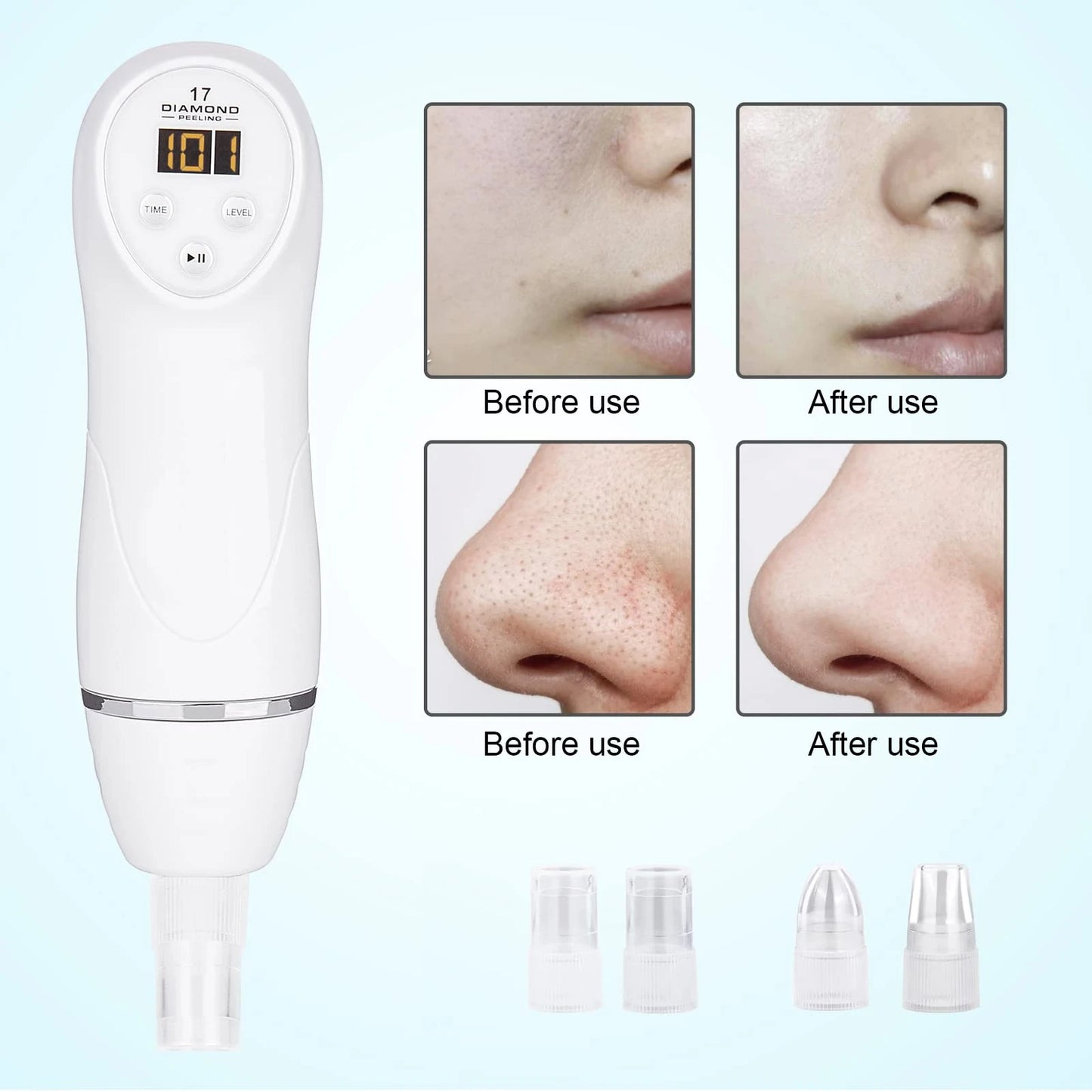 LESEN Diamond Microdermabrasion Blackhead Absorber Blackhead & Acne Cleanser Pore Cleansing Massager Exfoliating Skin Care Tools