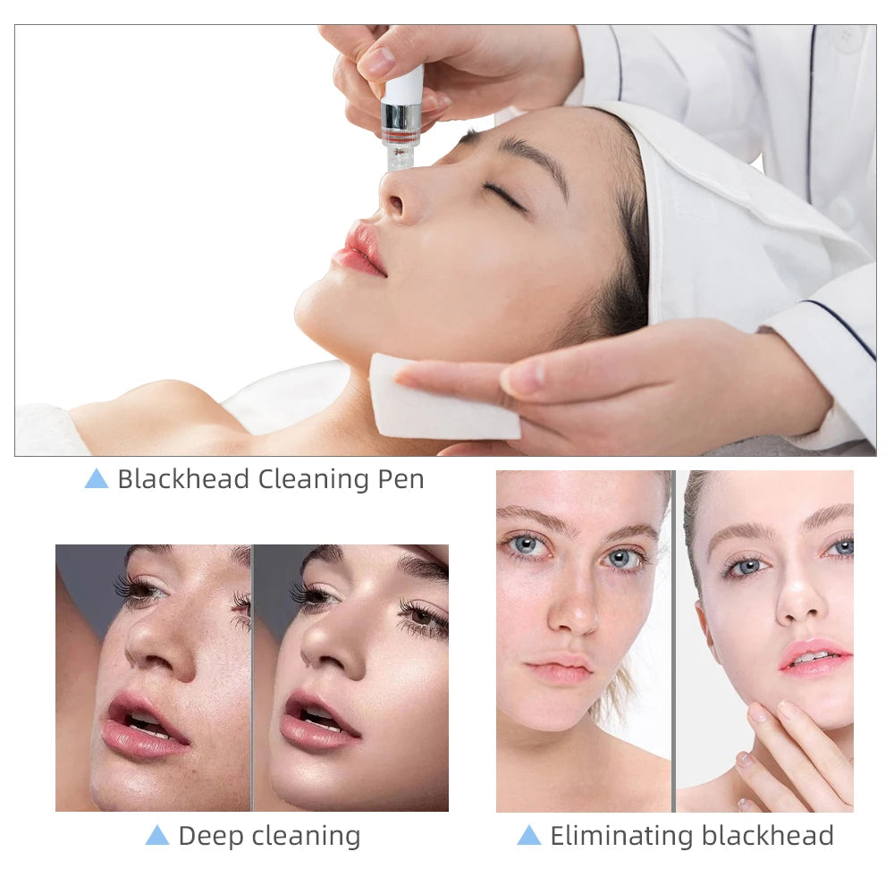 Hydro Water Oxygen Jet Peel Machine Oxy Spray Facial Machine Face Cleaning RF Lifting Dermabrasion Skin Care Beauty Device Spa