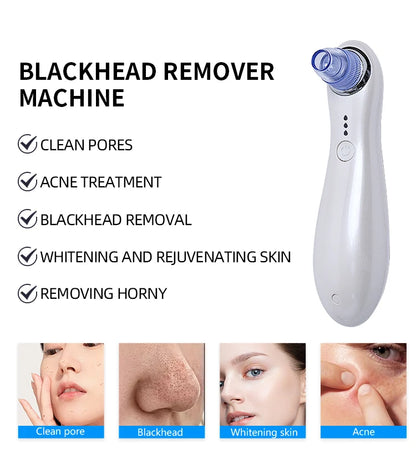 2025 Blackhead Remover Pore Vacuum Cleaner Electric Micro Small Bubble Facial Cleasing Machine USB Rechargeable Beauty Device