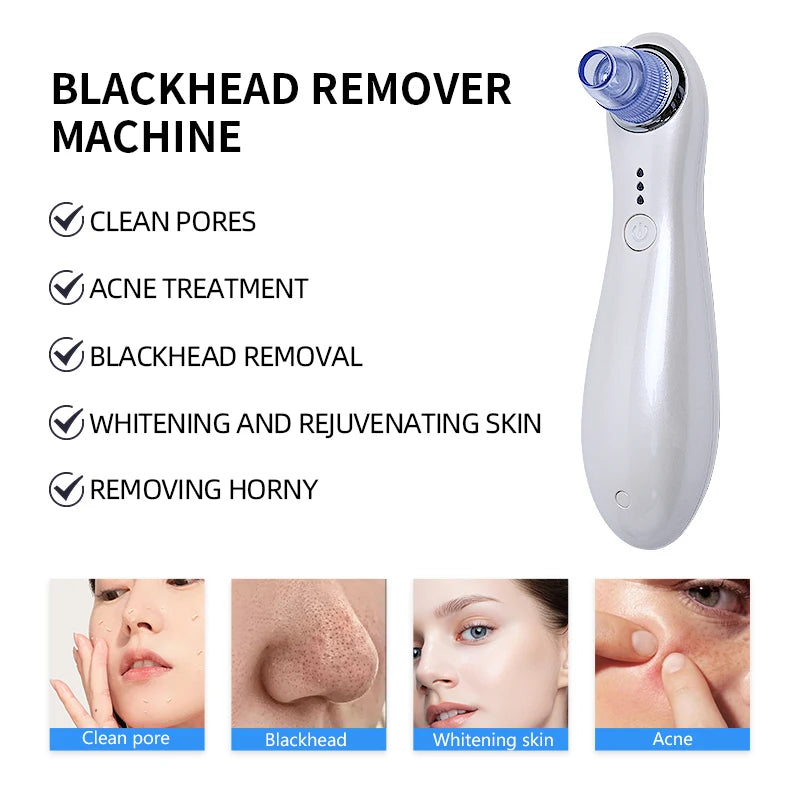 2025 Blackhead Remover Pore Vacuum Cleaner Electric Micro Small Bubble Facial Cleasing Machine USB Rechargeable Beauty Device